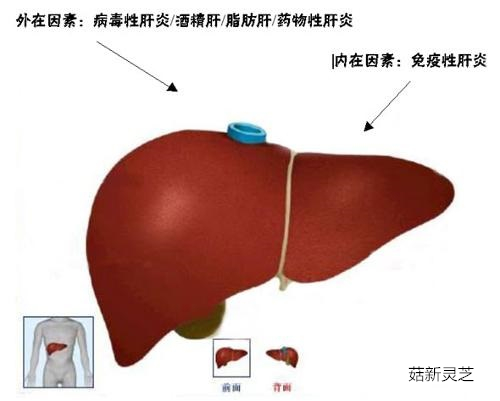 破壁灵芝孢子粉可保肝护肝