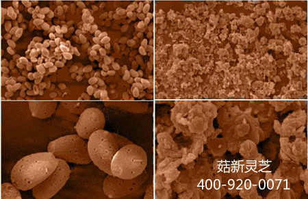 电子显微镜下两款灵孢子粉的对比图